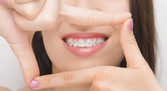 Ortodontia e Aparelhos